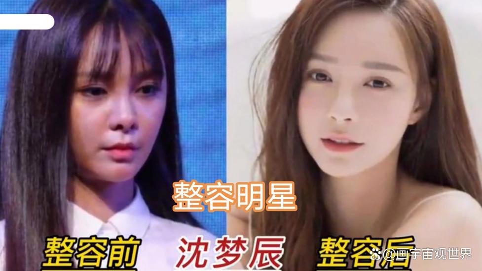 女明星的“脸”：从整容坦荡到素颜破圈，颜值内卷何时休？